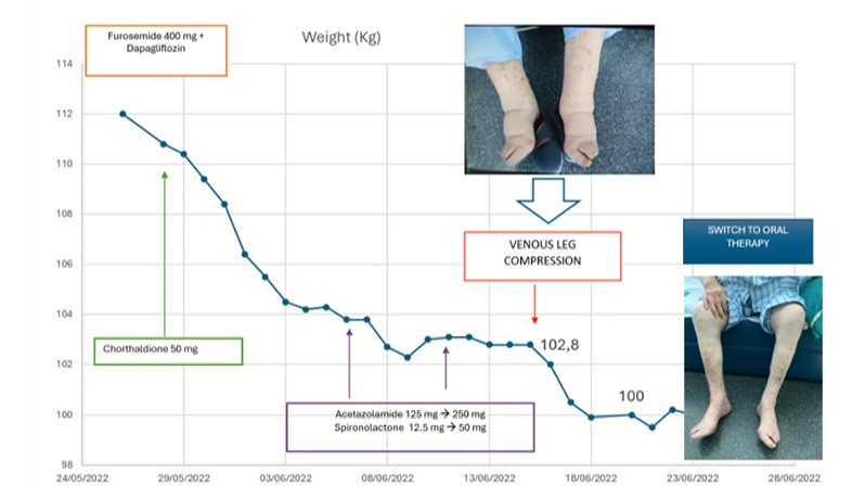 Bringing intelligence to decongestion management