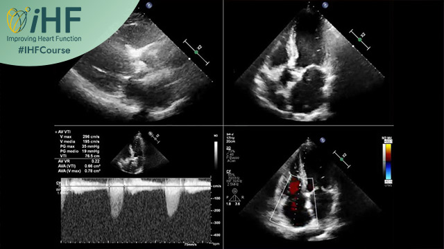 Navigating a Challenging Cardiorenal Dilemma