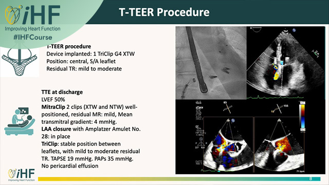 When Valves Collide: Managing Acute Heart Failure in the Real World