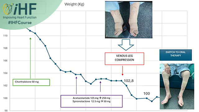 Bringing intelligence to decongestion management