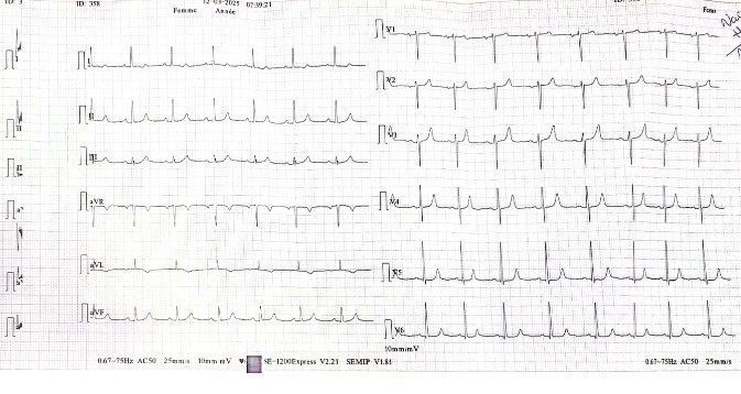 Electrocardiogram